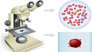 Fumare e donare sangue per i test