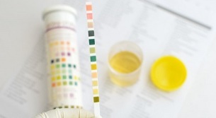 Posso fumare prima di urinare per l'analisi